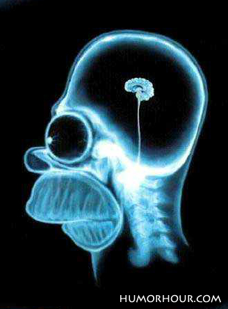 Homer's Brain